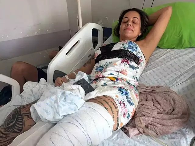 Sobrevivente de acidente com ambulância na BR-060, em Sidrolândia, aguarda cirurgia há quatro dias